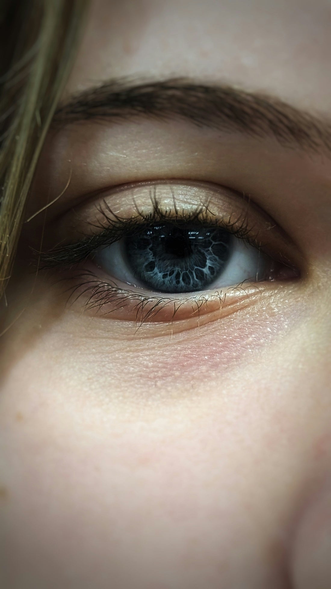 Dark Circles Under Eyes: Causes and Skincare Solutions